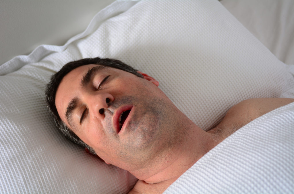 睡眠窒息症