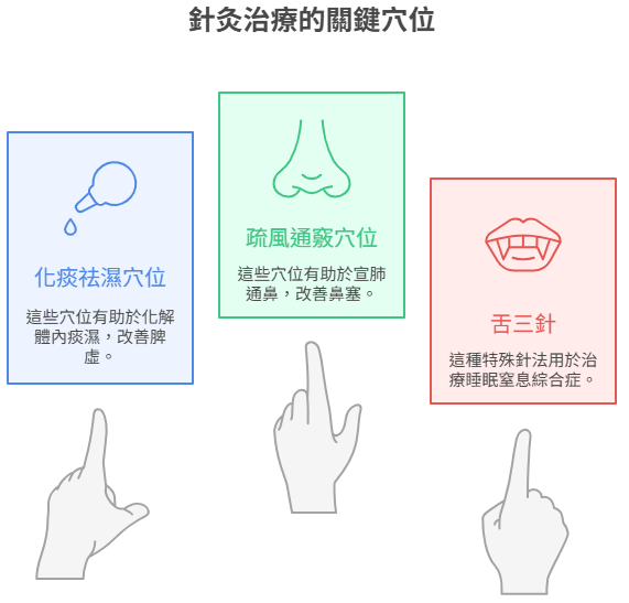 針灸治療的關鍵穴位