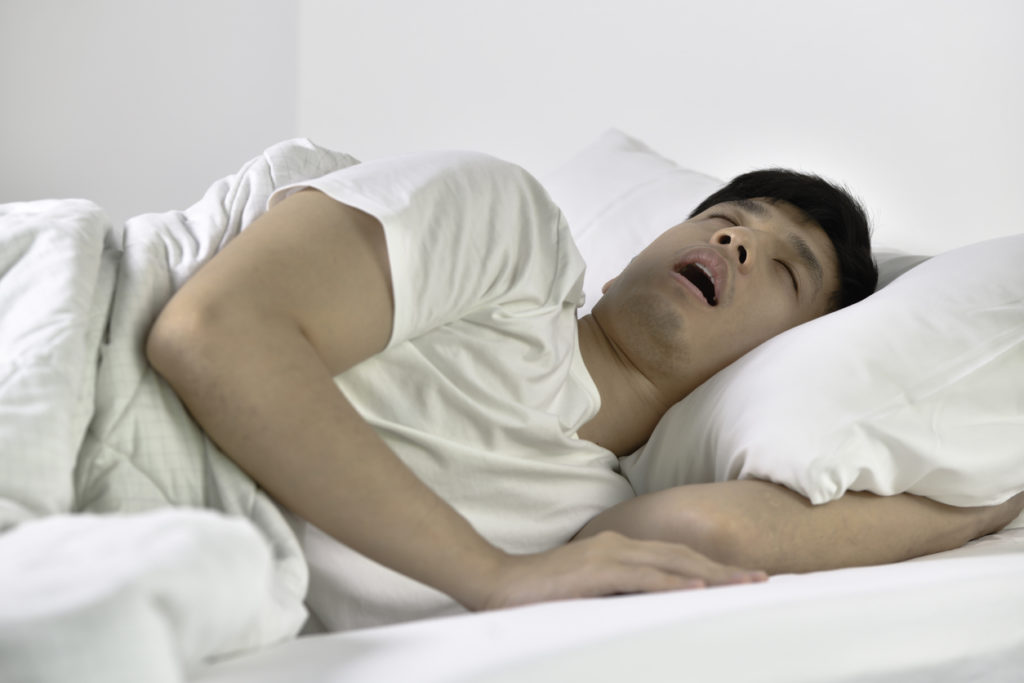 睡眠窒息症