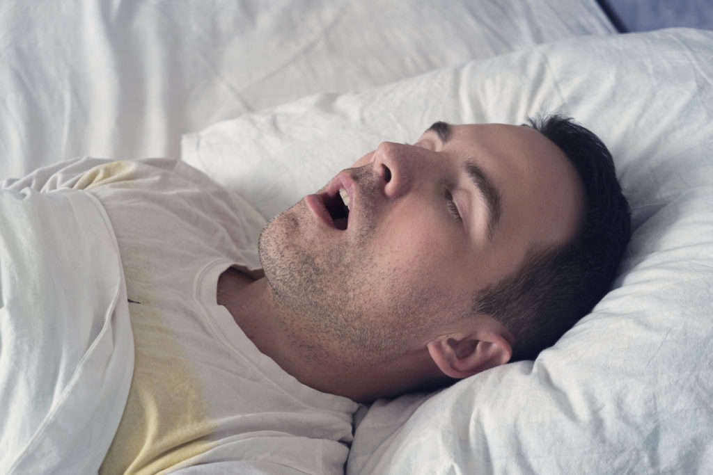 睡眠窒息症